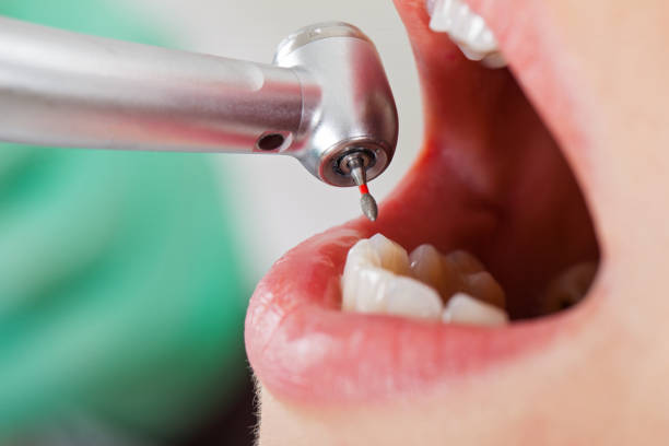 Best Weekend Emergency Dentist in Crystal, MN